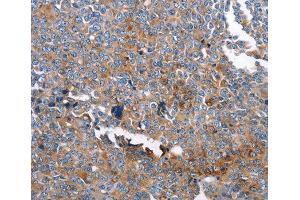 Immunohistochemistry (IHC) image for anti-Gelsolin (GSN) (AA 543-782) antibody (ABIN3017055) (Gelsolin anticorps  (AA 543-782))
