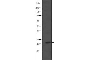 Western blot analysis of NKIRAS2 expression in A549 whole cell lysate ,The lane on the left is treated with the antigen-specific peptide. (NKIRAS2 anticorps  (C-Term))