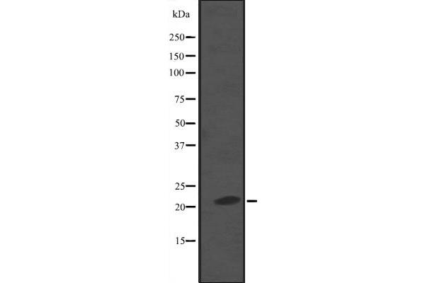 NKIRAS2 antibody  (C-Term)