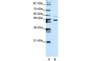 WB Suggested Anti-ZNF558 Antibody Titration:  0. (ZNF558 anticorps  (N-Term))