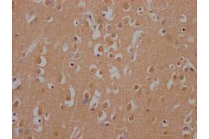 IHC image of ABIN7127558 diluted at 1:100 and staining in paraffin-embedded human brain tissue performed on a Leica BondTM system. (Recombinant Huntingtin anticorps)