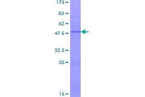 Image no. 1 for NADH Dehydrogenase (Ubiquinone) Fe-S Protein 7, 20kDa (NADH-Coenzyme Q Reductase) (NDUFS7) (AA 1-213) protein (GST tag) (ABIN1312289)
