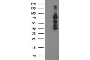 Western Blotting (WB) image for anti-Katanin P80 (WD Repeat Containing) Subunit B 1 (KATNB1) antibody (ABIN1498990) (KATNB1 anticorps)