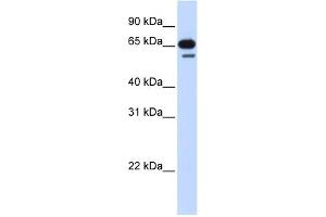 WB Suggested Anti-R3HDM2 Antibody Titration: 0. (R3HDM2 anticorps  (Middle Region))