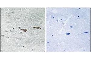 Immunohistochemistry analysis of paraffin-embedded human brain tissue, using TOB1 (Ab-164) Antibody. (Protein Tob1 (TOB1) (AA 130-179) anticorps)