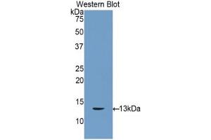 Western blot analysis of the recombinant protein. (Connexin 31 anticorps  (AA 7-102))