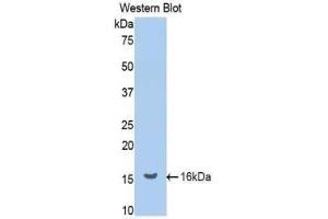 Western blot analysis of the recombinant protein. (Renin anticorps  (AA 265-386))
