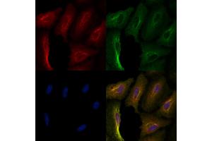 ABIN6257514 and ABIN6276058 staining  cells by IF/ICC. (TACR1 anticorps  (Internal Region))