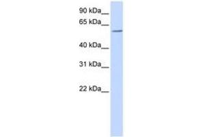 Image no. 1 for anti-Zinc Finger and BTB Domain Containing 7A (ZBTB7A) (AA 108-157) antibody (ABIN6740515) (ZBTB7A anticorps  (AA 108-157))
