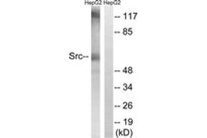 Western blot analysis of extracts from HepG2 cells, using Src (Ab-216) Antibody. (Src anticorps  (AA 181-230))