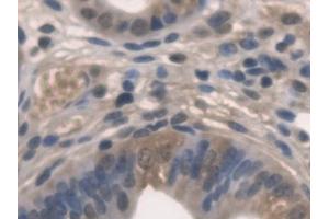 Detection of PNPO in Mouse Uterus Tissue using Polyclonal Antibody to Pyridoxamine-5'-Phosphate Oxidase (PNPO)