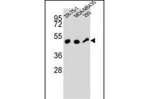ZFP30 Antibody (N-term) (ABIN657359 and ABIN2846409) western blot analysis in ZR-75-1,MDA-M,293 cell line lysates (35 μg/lane). (ZFP30 anticorps  (N-Term))