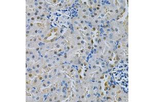 Immunohistochemistry of paraffin-embedded rat kidney using SPHK1 Antibody (ABIN5970017) at dilution of 1/200 (40x lens). (SPHK1 anticorps)