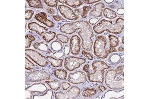 Immunohistochemical staining of human kidney with COX14 polyclonal antibody  shows strong cytoplasmic positivity in cells in tubules. (COX14 anticorps)