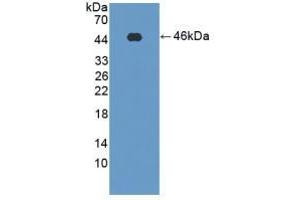 Detection of Recombinant PFKM, Rat using Polyclonal Antibody to Phosphofructokinase, Muscle (PFKM) (PFKM anticorps  (AA 2-390))
