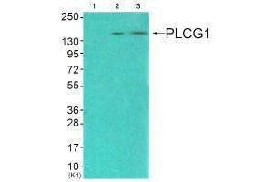 Western blot analysis of extracts from COS7 cells (Lane 2), and JK cells (Lane 3), using PLCG1 (Ab-771) antiobdy.