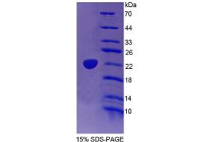 SDS-PAGE analysis of Human TRERF1 Protein. (TRERF1 Protéine)