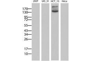 Image no. 2 for anti-ATP-Binding Cassette, Sub-Family B (MDR/TAP), Member 1 (ABCB1) (AA 347-710) antibody (ABIN1491437)