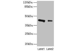Western blot All lanes: RAD23B antibody at 2 μg/mL Lane 1: 293T whole cell lysate Lane 2: MCF-7 whole cell lysate Secondary Goat polyclonal to rabbit IgG at 1/10000 dilution Predicted band size: 44, 36 kDa Observed band size: 44 kDa (RAD23B anticorps  (AA 1-250))