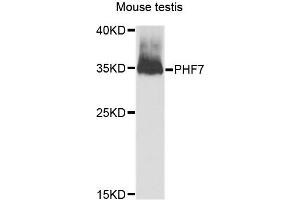 Western blot analysis of extracts of Mouse testis cells, using PHF7 antibody. (PHF7 anticorps)