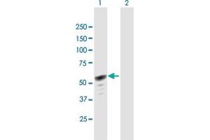 Western Blot analysis of HERPUD1 expression in transfected 293T cell line by HERPUD1 MaxPab polyclonal antibody.