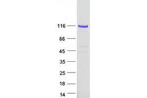 Validation with Western Blot