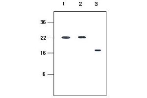Western Blotting (WB) image for anti-Killer Cell Immunoglobulin-Like Receptor, Two Domains, Long Cytoplasmic Tail, 4 (KIR2DL4) antibody (ABIN6245707)