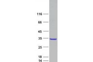 Validation with Western Blot