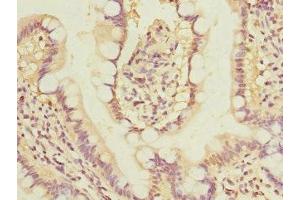 Immunohistochemistry of paraffin-embedded human small intestine tissue using ABIN7153881 at dilution of 1:100 (GLP2R anticorps  (AA 1-180))