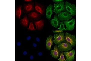ABIN6262120 and ABIN6273253 staining Hela cells by IF/ICC.