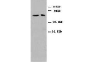 Western blot analysis of rat cardiac muscle tissue lysis using MFN antibody (MFN2 anticorps  (N-Term))
