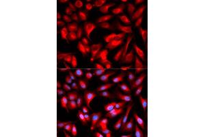 Immunofluorescence analysis of U2OS cell using HMMR antibody.