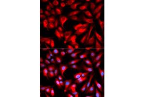 Immunofluorescence analysis of U2OS cell using HMMR antibody. (HMMR anticorps  (AA 341-440))