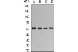 Western blot analysis of UGT1A1 expression in HepG2 (A), SHSY5Y (B), mouse liver (C), rat liver (D) whole cell lysates. (UGT1A1 anticorps)