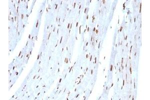Formalin-fixed, paraffin-embedded rat heart stained with SUMO-2 antibody. (SUMO2 anticorps)
