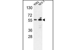 Western blot analysis of G6PD Antibody (Center) (ABIN651286 and ABIN2840171) in K562,MCF-7 cell line lysates (35 μg/lane). (Glucose-6-Phosphate Dehydrogenase anticorps  (AA 297-326))