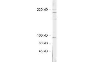 dilution: 1 : 1000, sample: rat hippocampus homogenate