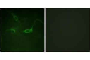 Immunofluorescence analysis of COS7 cells, using FGFR1 (Phospho-Tyr654) Antibody. (FGFR1 anticorps  (pTyr654))