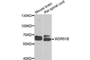 Western blot analysis of extracts of mouse brain and rat spinal cord  cell lines, using WDR51B( POC1B ) antibody. (POC1B anticorps)