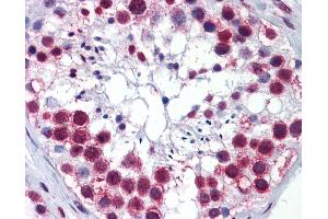 Anti-RSL24D1 / C15orf15 antibody IHC of human testis. (RSL24D1 anticorps  (AA 1-151))