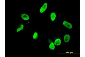Immunofluorescence of monoclonal antibody to RNF168 on HepG2 cell. (RNF168 anticorps  (AA 462-571))