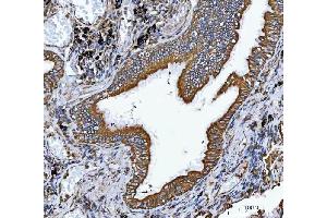 IHC analysis of VAPA using anti-VAPA antibody (ABIN7603249). (VAPA anticorps  (N-Term))