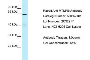 Western Blotting (WB) image for anti-Myotubularin Related Protein 6 (MTMR6) (C-Term) antibody (ABIN2789053) (MTMR6 anticorps  (C-Term))