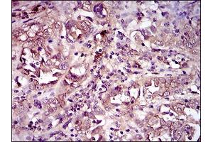 Immunohistochemical analysis of paraffin-embedded endometrium tissues using CD33 mouse mAb with DAB staining.