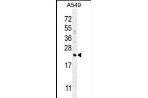 CFD Antibody (N-term) (ABIN656025 and ABIN2845399) western blot analysis in A549 cell line lysates (35 μg/lane). (Adipsin anticorps  (N-Term))