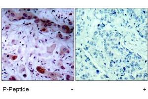 Image no. 1 for anti-Janus Kinase 1 (JAK1) (pTyr1022) antibody (ABIN196869) (JAK1 anticorps  (pTyr1022))