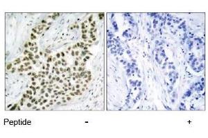 Image no. 3 for anti-H2A Histone Family, Member X (H2AFX) (Ser139) antibody (ABIN197525) (H2AFX anticorps  (Ser139))