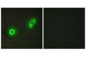 Immunofluorescence analysis of A549 cells, using Ik3-2 antibody. (CABLES2 anticorps)