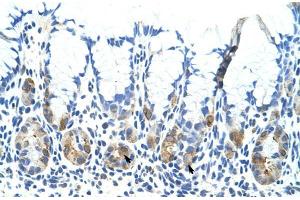 Human Stomach; Rabbit Anti-ADAT1 Antibody. (ADAT1 anticorps  (C-Term))