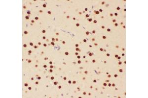 Anti-ATF2 Picoband antibody,  IHC(P): Rat Brain Tissue